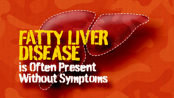 Fatty liver disease is often present without symptoms