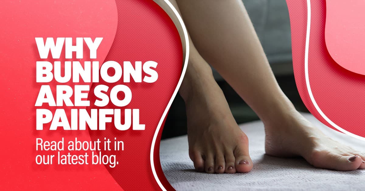 Why Bunions Are So Painful