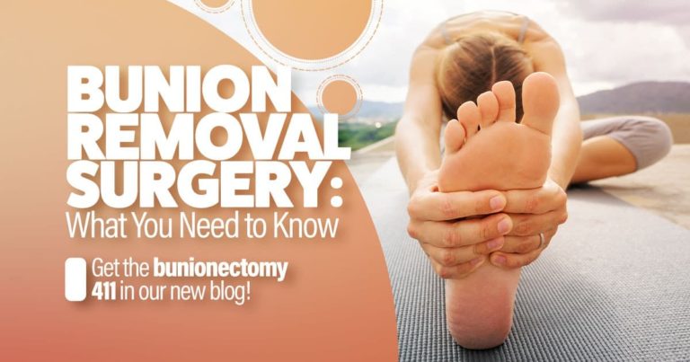 Bunion removal surgery: What you need to know