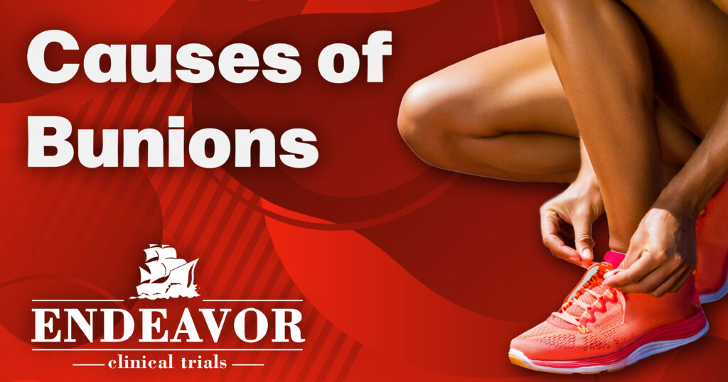 Bunions: Causes, Symptoms, Treatment Options, And The Role Of Clinical ...